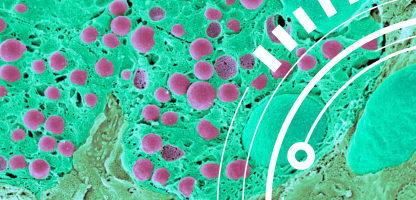 turquoise background of pink cells showing nuclei segmentation - technote thumbnail